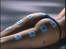 Elettrostimolazione
